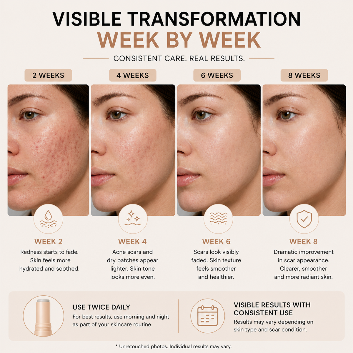 Acne Scar Repair Stick