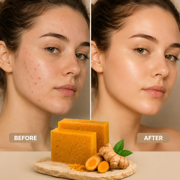Turmeric Kojic Acid Handmade Soap